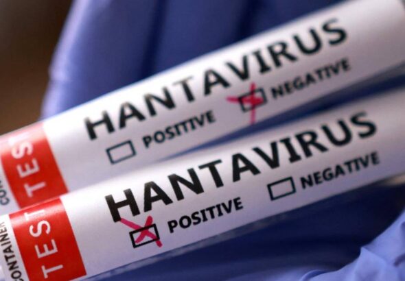 avrupada-bir-hantavirus-suphesi-daha-lDK8MwLx
